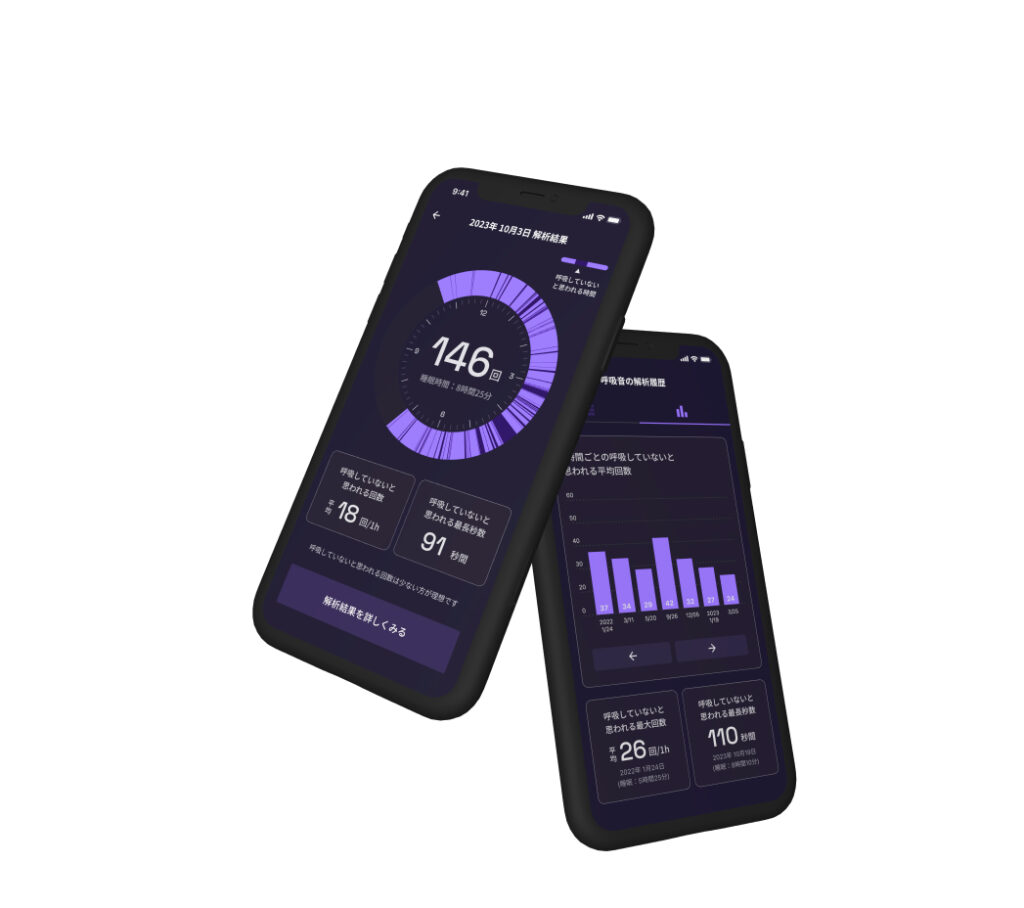ZzzMeter